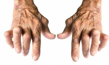 Romatizma Nedir? Romatizma Türleri, Belirtileri ve Bitkisel Tedavisi!